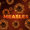 Measles