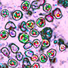 Measles Virus